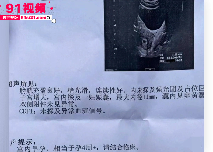 娱乐圈大瓜清纯女星 李沁 被爆密会小米创始人 雷军 多次开房怀孕堕胎 10万陪睡补偿内幕全网震惊 - 图22