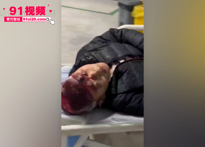 山东潍坊寿光市金光街大桥发生持刀火拼 百名团伙成员手持关公刀砍人现场视频曝光 据传组织砍人者是公安局长 王滨 的干儿子 - 图8