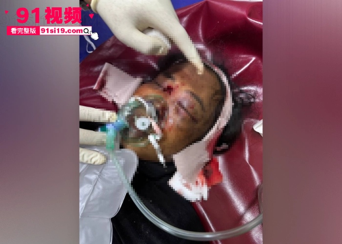 泰国军方空袭柬埔寨导致平民受伤 数万民众流离失所 两国新一轮冲突爆发 - 图14