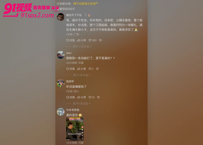 东方会喷火的龙 神不在新西兰 直播时手机被抢遭十余人暴力围殴 鼻子骨折满脸是血 现场视频流出引发热议 - 图2