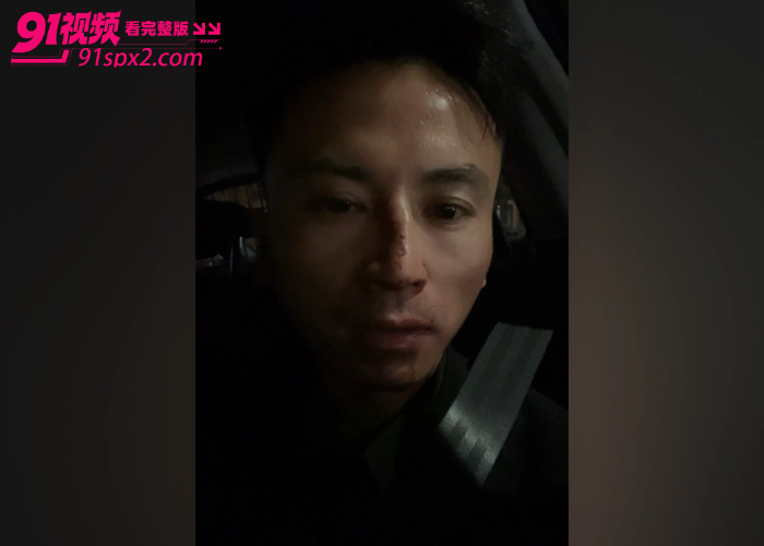 东方会喷火的龙 神不在新西兰 直播时手机被抢遭十余人暴力围殴 鼻子骨折满脸是血 现场视频流出引发热议 - 图15