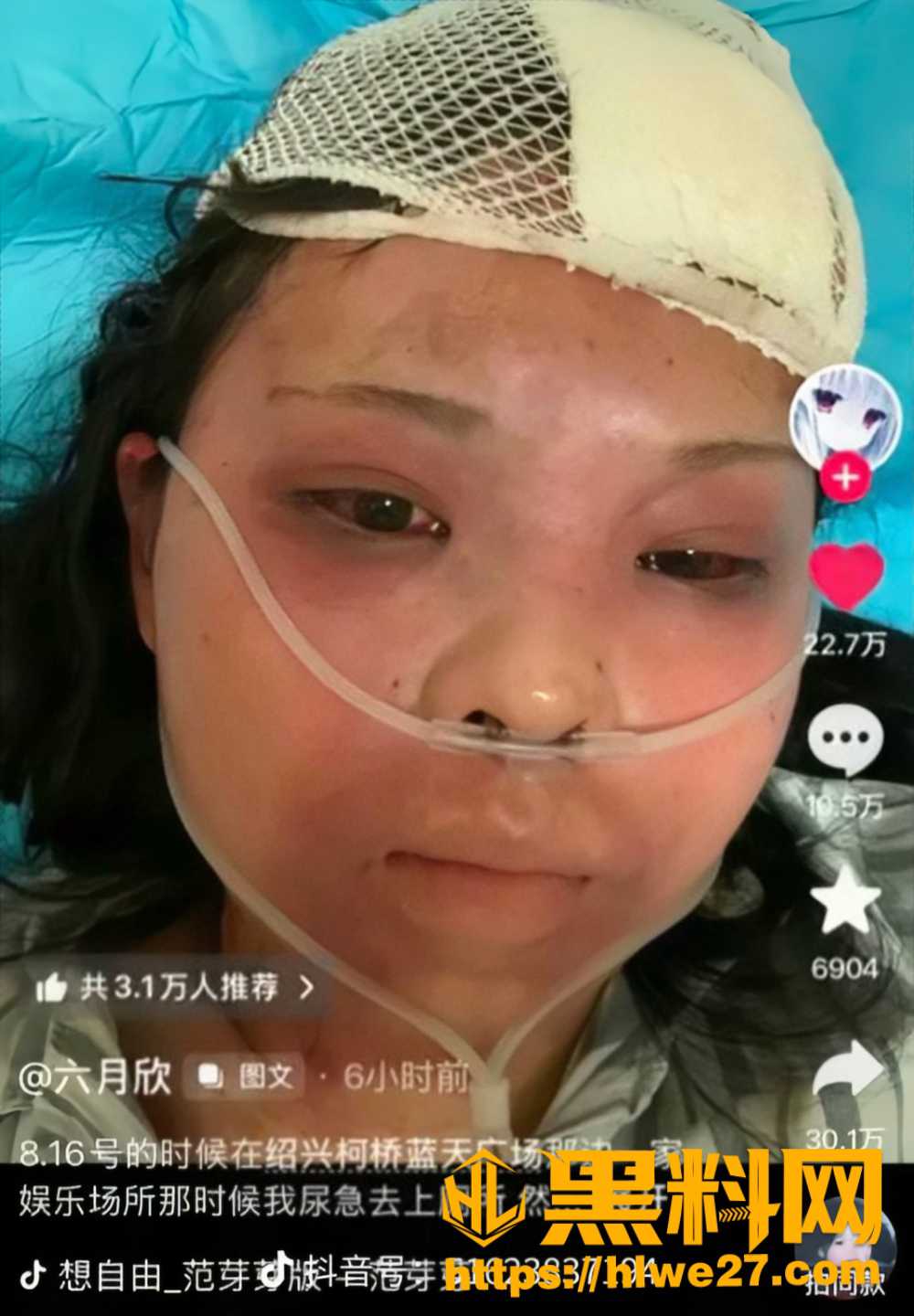 抖音网红六月欣13