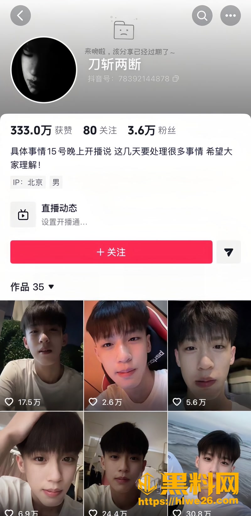 01抖音男网红刀斩两断1 1wm
