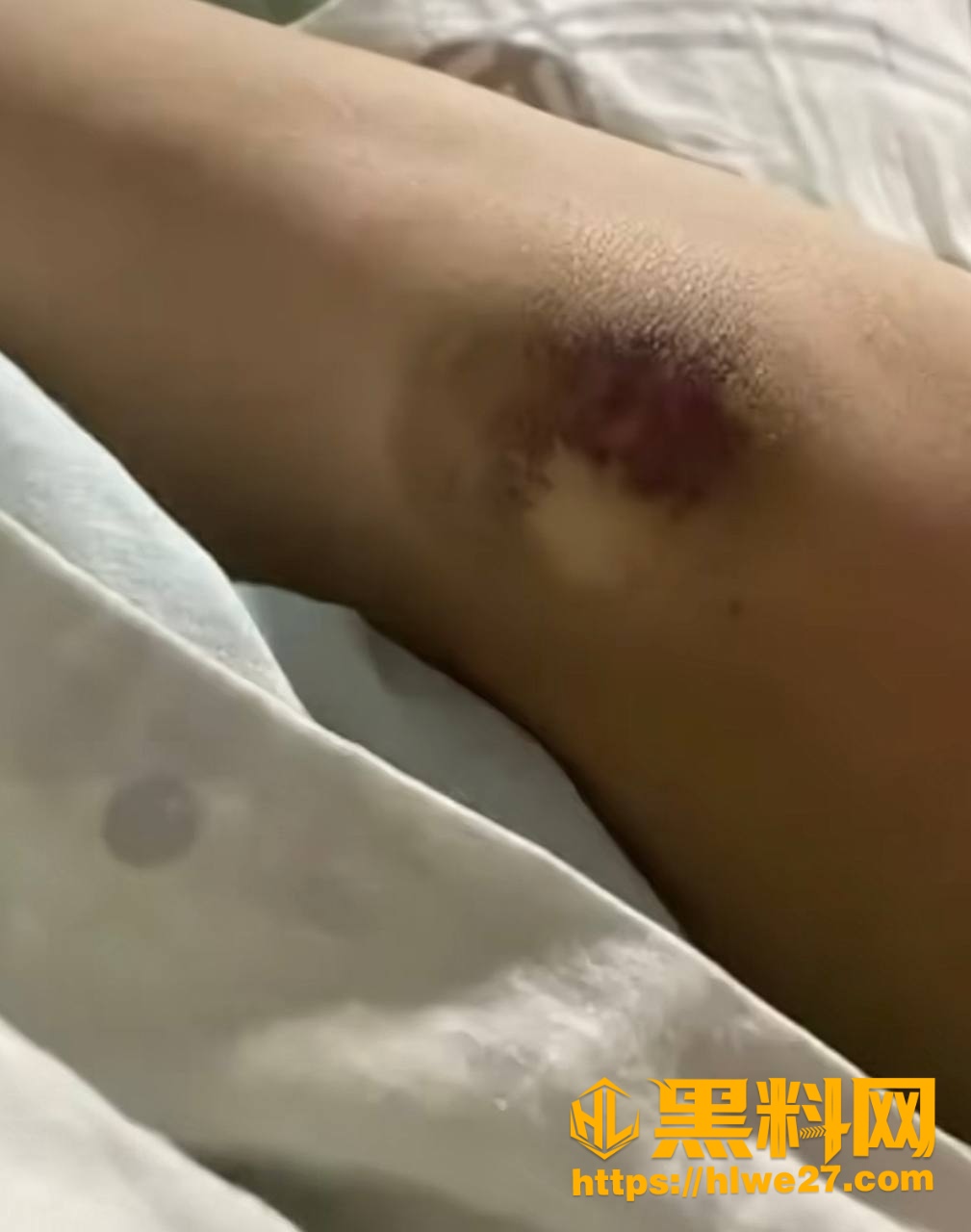 家暴2