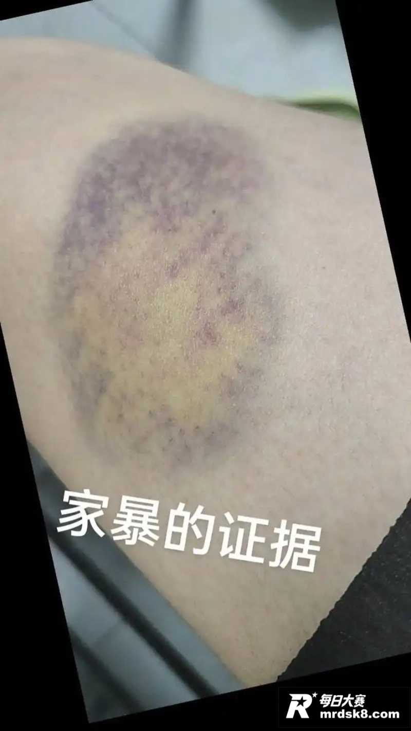 前国脚球员 孙吉 被相关图片17