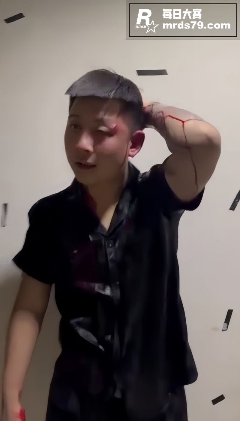 精神小伙暴力事件 只相关图片7