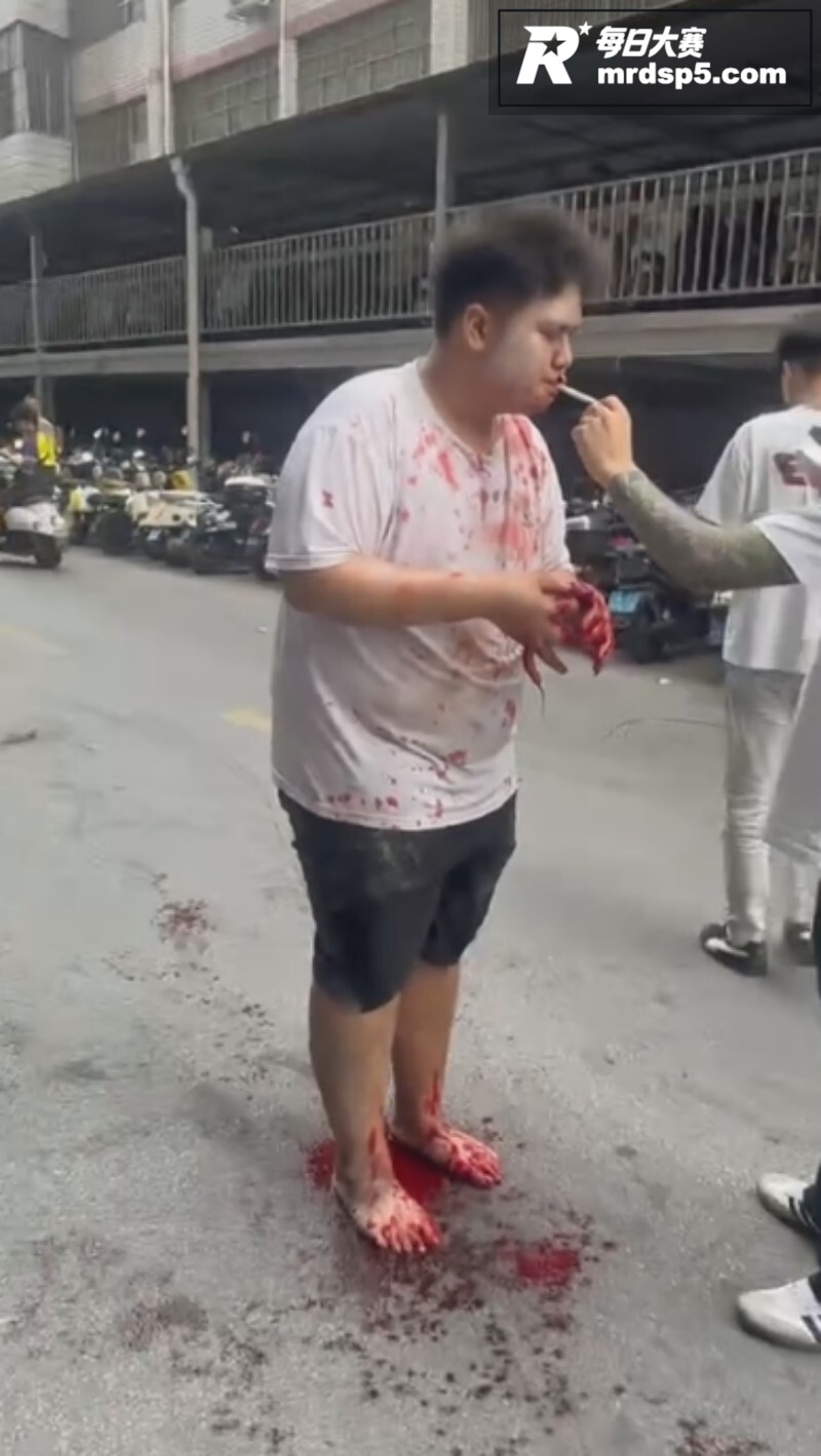 南宁大学公园血腥恶性相关图片3
