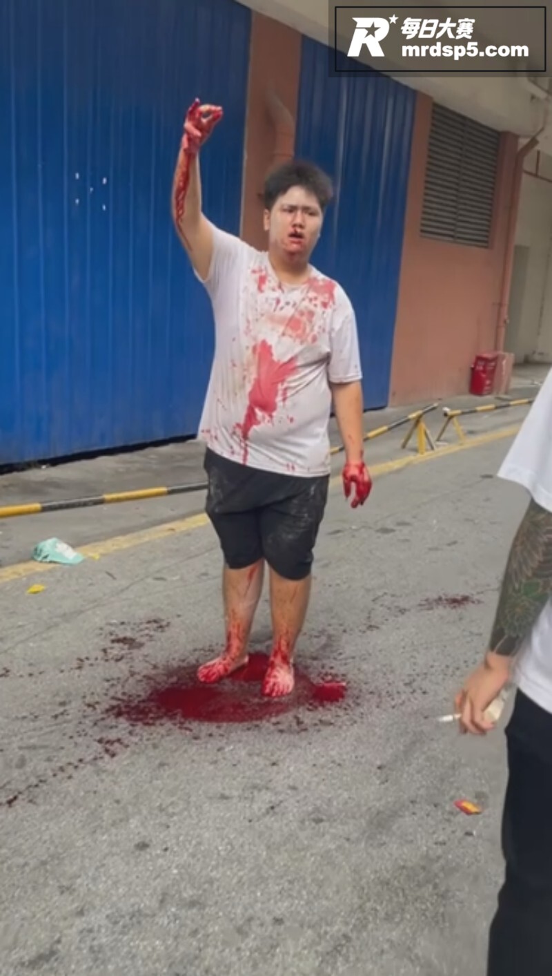 南宁大学公园血腥恶性相关图片4