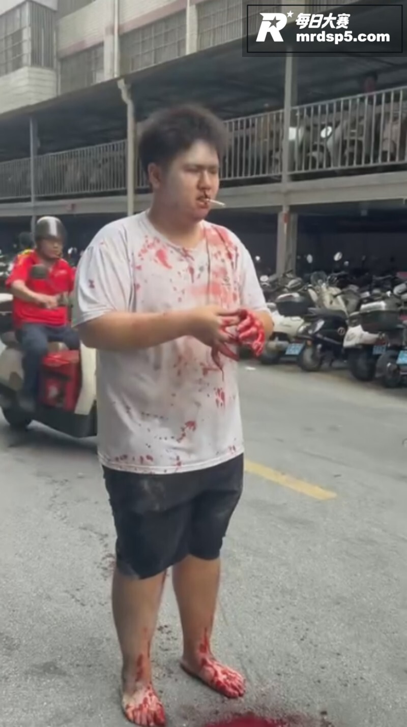 南宁大学公园血腥恶性相关图片5