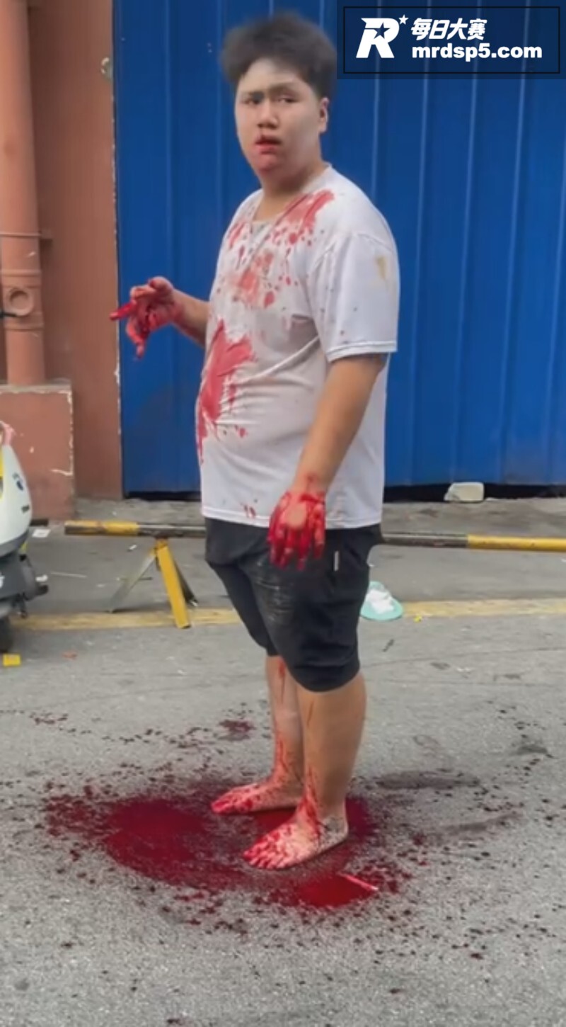 南宁大学公园血腥恶性相关图片6