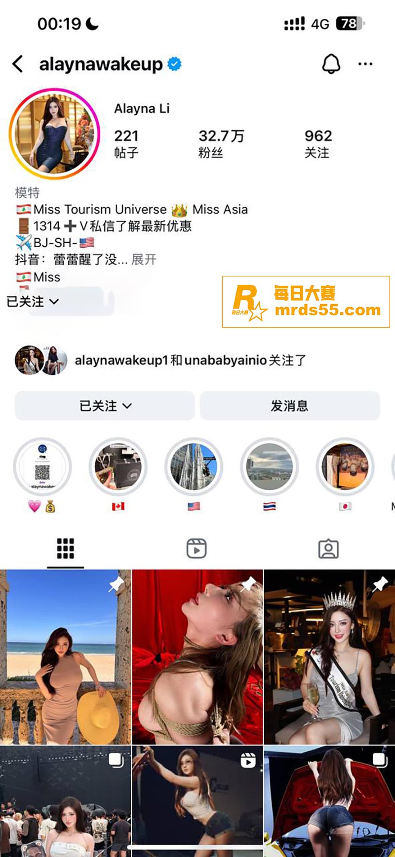 抖音30万粉丝网红 相关图片3