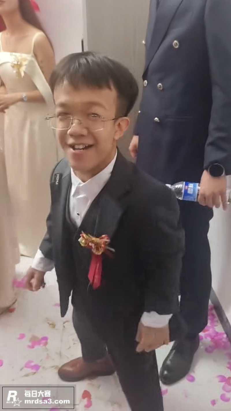 当代武大郎 侏儒症大相关图片3