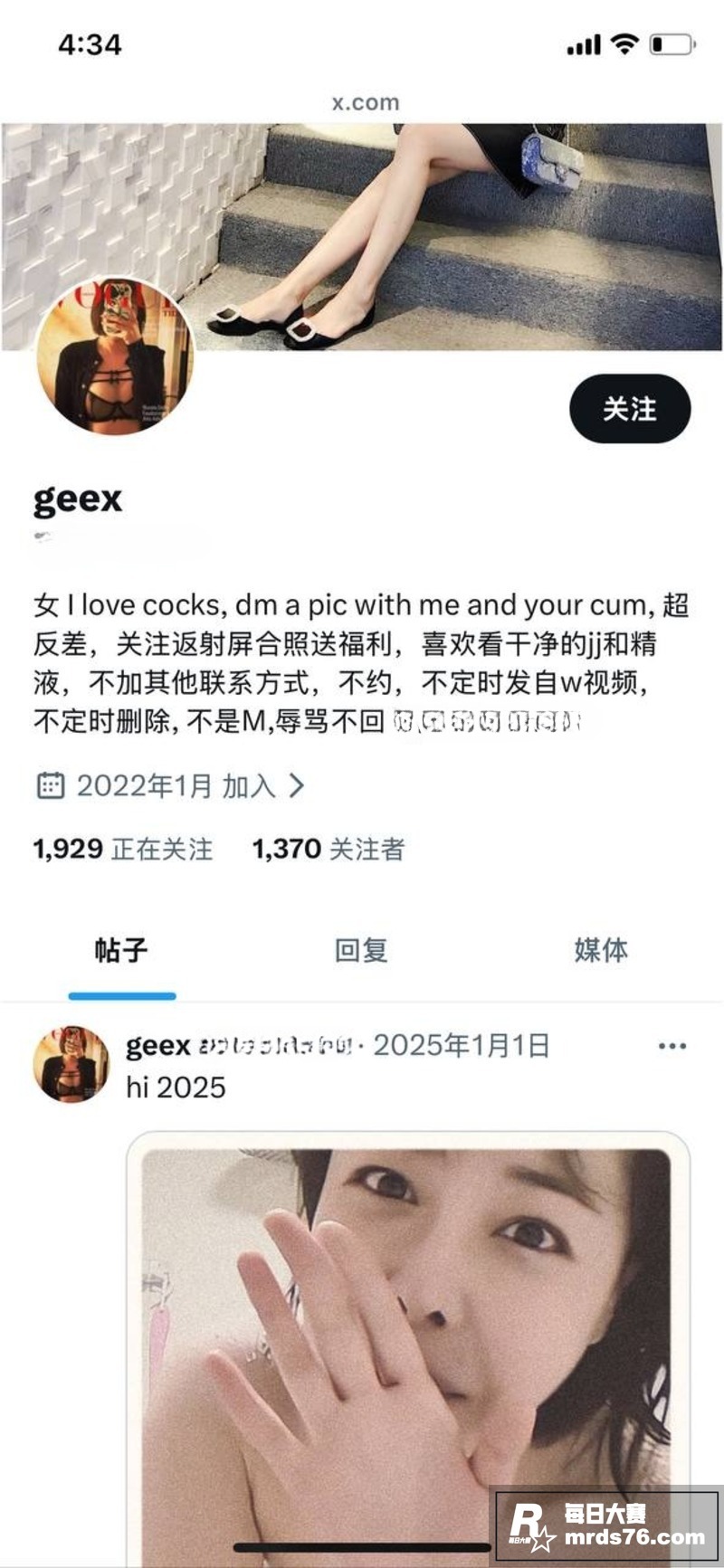 蜜桃臀医美销售 小雨相关图片1