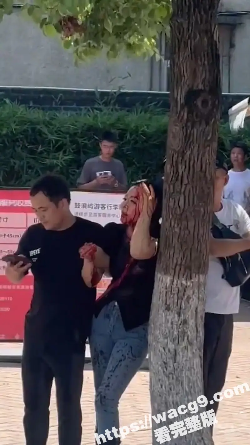 突发事件!厦门一对夫妻从思明区法院鼓浪屿分院办理离婚后 丈夫突然从包里拿出折叠刀捅向妻子头部 图2