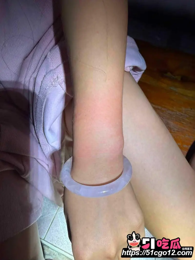 中国女子泰国行 遭4名男子绑架 去往泰缅途中跳车自救 过程胆战心惊! 图10