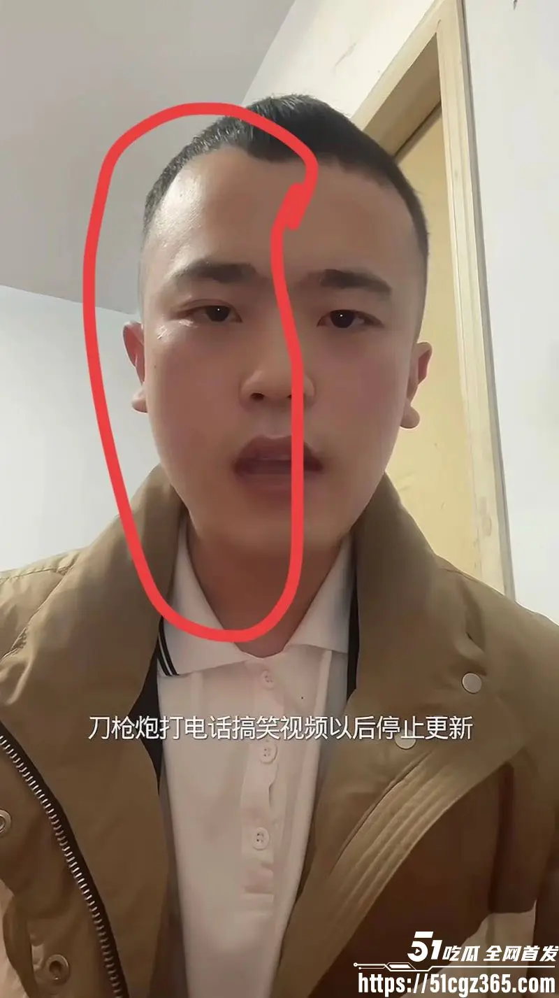 精神小伙 崔玉彬 为流量热度 电话撩临沂刀枪炮 被大哥怒怼打肿脸 视频全清连夜发视频鞠躬道歉! 图1