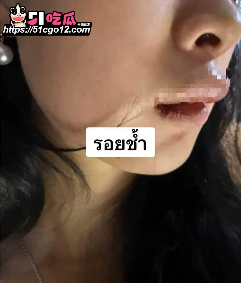 中国女子泰国行 遭4名男子绑架 去往泰缅途中跳车自救 过程胆战心惊! 图8
