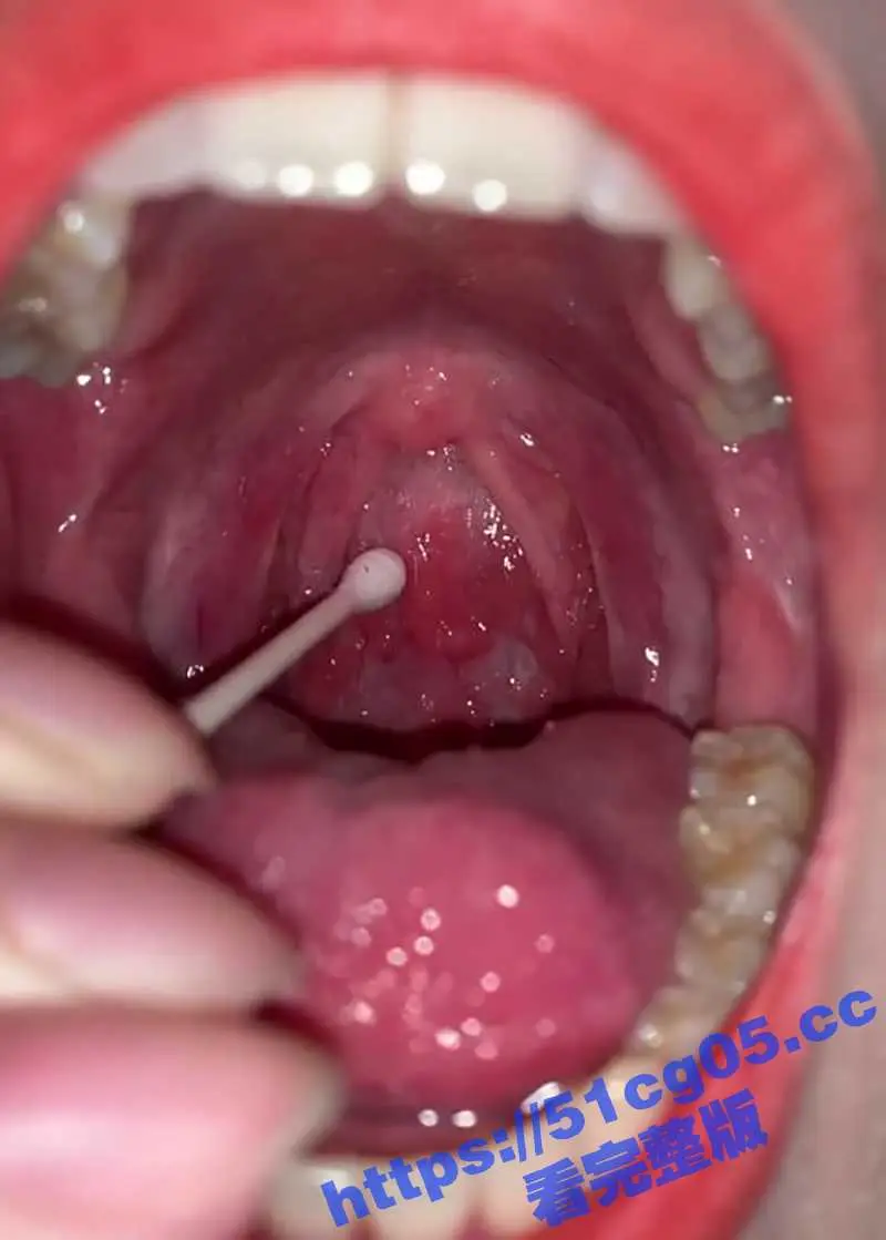 超极品美女口腔检查系列 粉嫩口腔小舌头 紧致的喉咙 这嘴巴用来深喉口爆绝对很爽 ! 图7