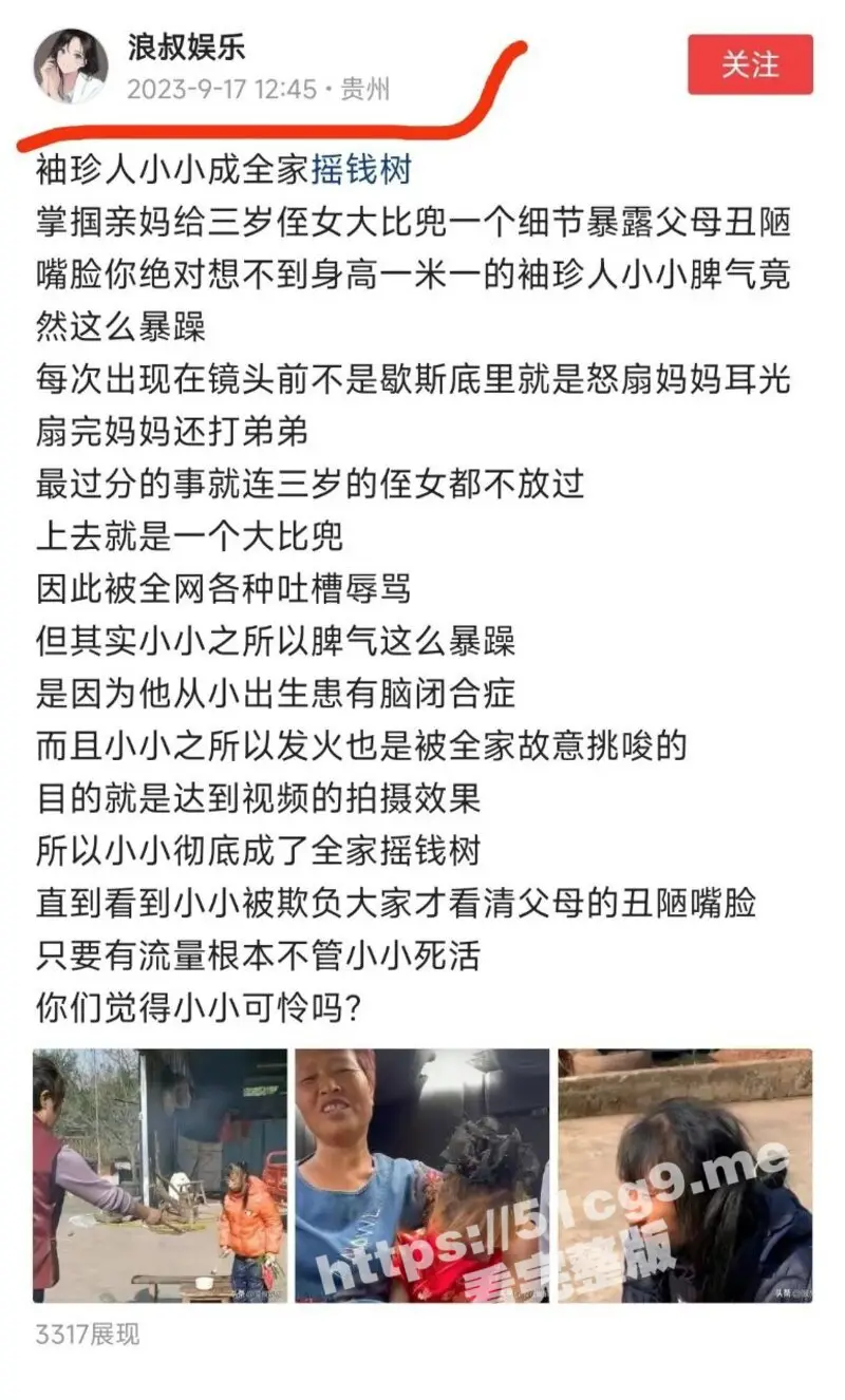 网红 袖珍女孩 脾气暴躁大反转 经遭亲妈残忍虐待挨毒打 全家人当她做摇钱树 早前曝光无人理 图1