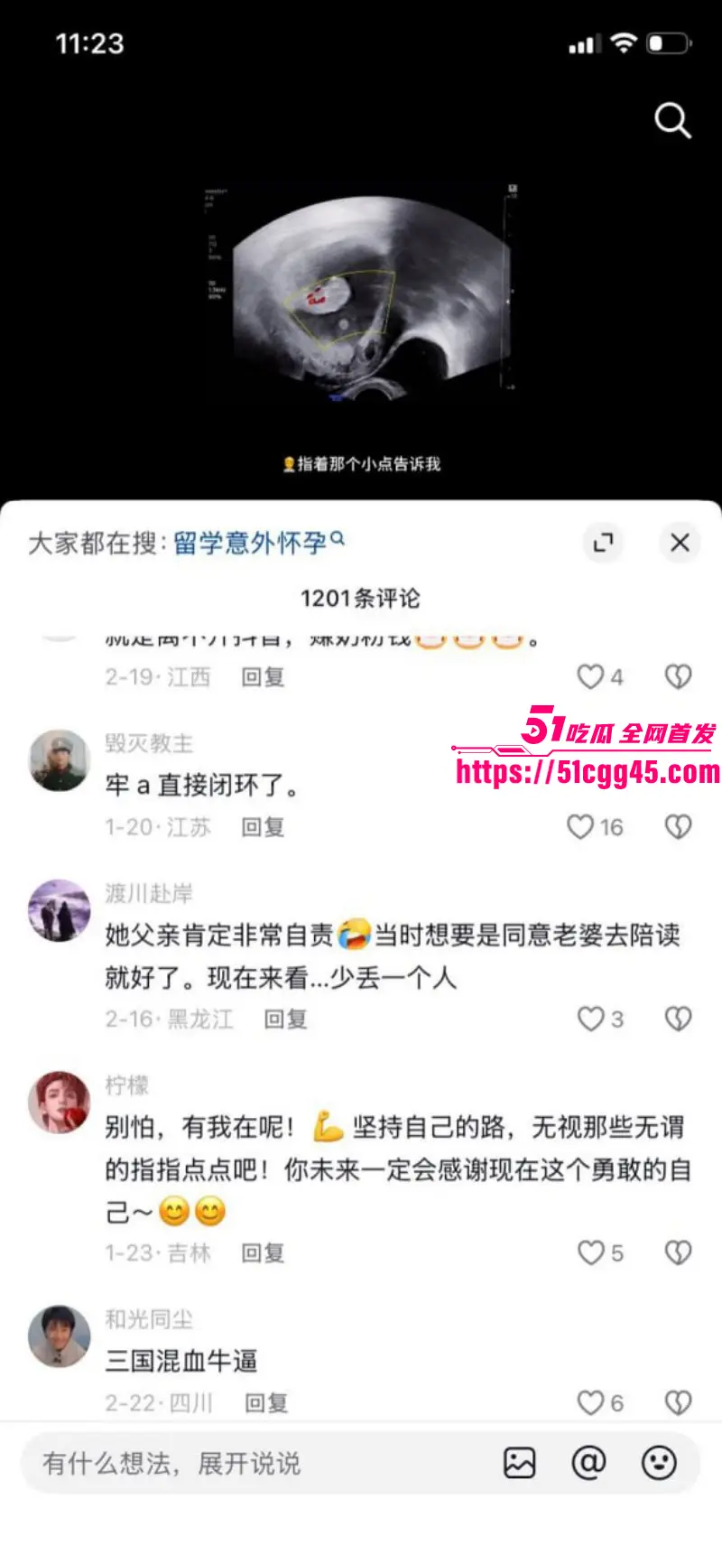 德国留学生亚洲马桶 攀小宝 被老外玩三通一达 操怀孕后回国找接盘侠 被网友扒出3P肛交视频! 图17
