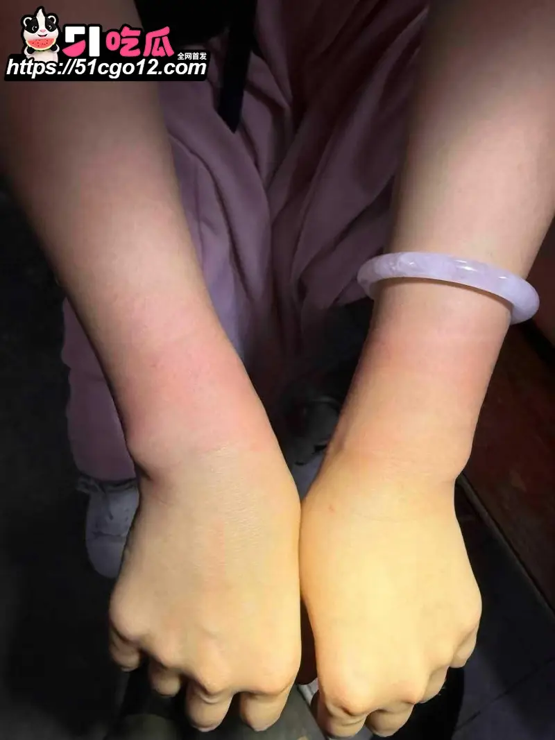 中国女子泰国行 遭4名男子绑架 去往泰缅途中跳车自救 过程胆战心惊! 图11