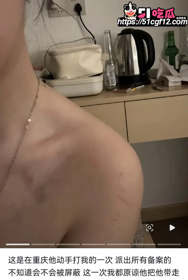 陕西渣男 秦俊男 被曝恋爱期间多次出轨 家暴打人割腕威胁 就连姐姐的伴娘都不放过? 图18