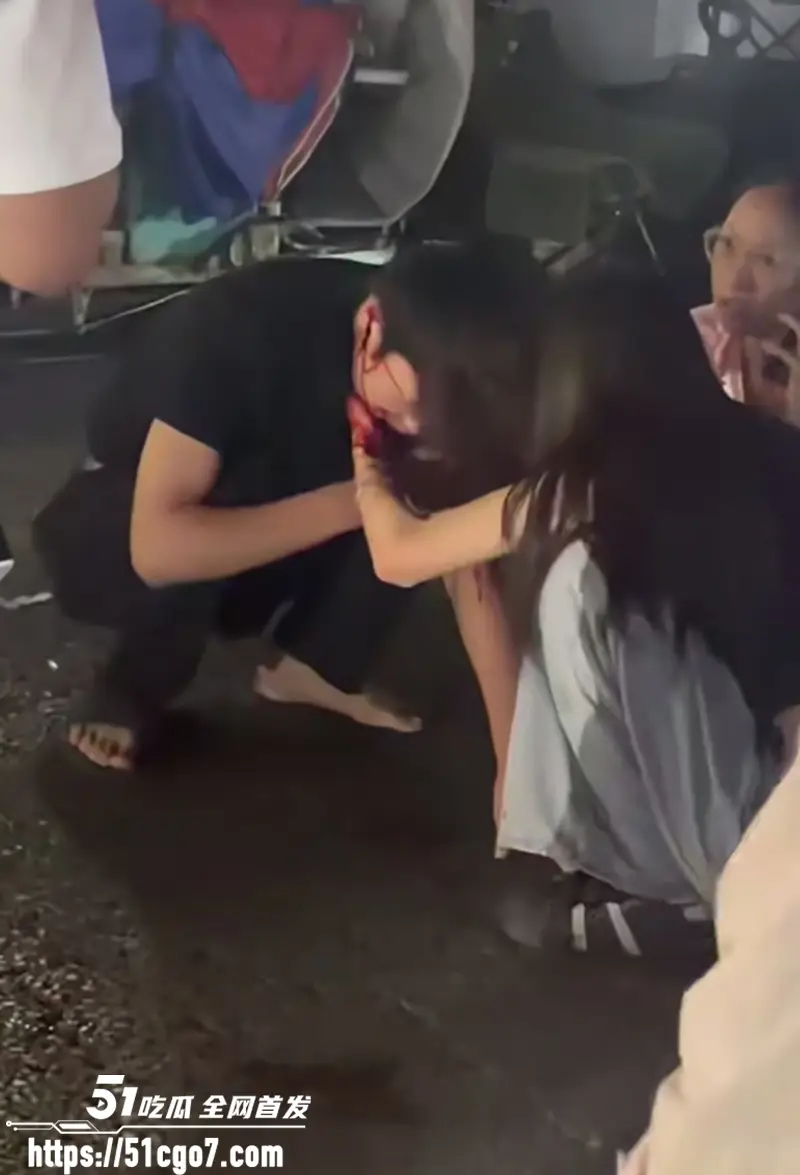 枣庄夜市爆出命案 情侣购买幼犬遇壮汉截胡 男友争论竟被当街打死 口鼻窜血惨不忍睹 图6