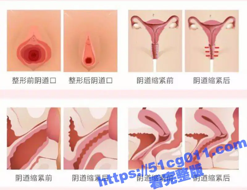 做紧致女人 让性福加倍!广州缩紧针火了 你的她为什么这么紧的原因来了! 图1