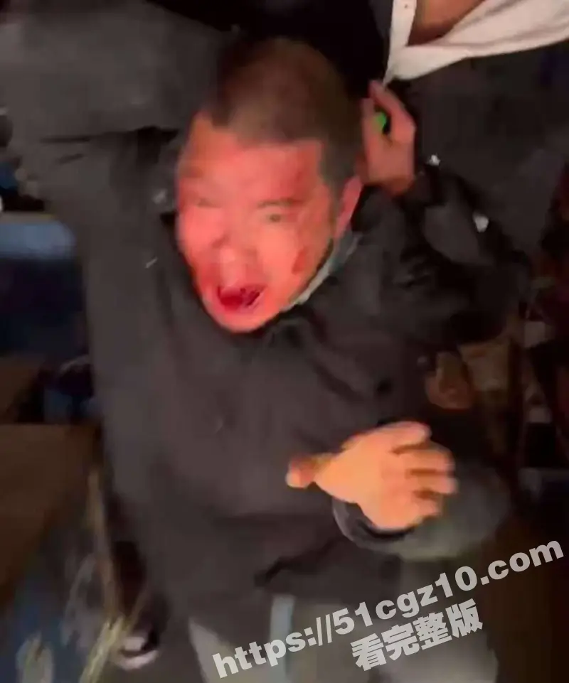 江苏启东打人事件 男子惨遭两黑衣人暴力虐打至双腿残废 伤人者竟轻松保释逍遥法外 图2