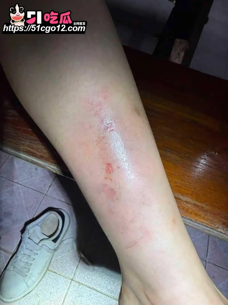 中国女子泰国行 遭4名男子绑架 去往泰缅途中跳车自救 过程胆战心惊! 图9