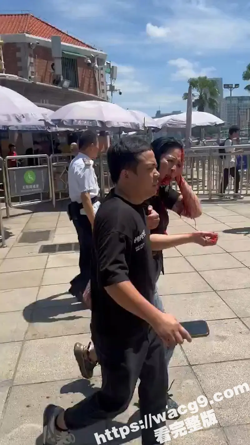 突发事件!厦门一对夫妻从思明区法院鼓浪屿分院办理离婚后 丈夫突然从包里拿出折叠刀捅向妻子头部 图1