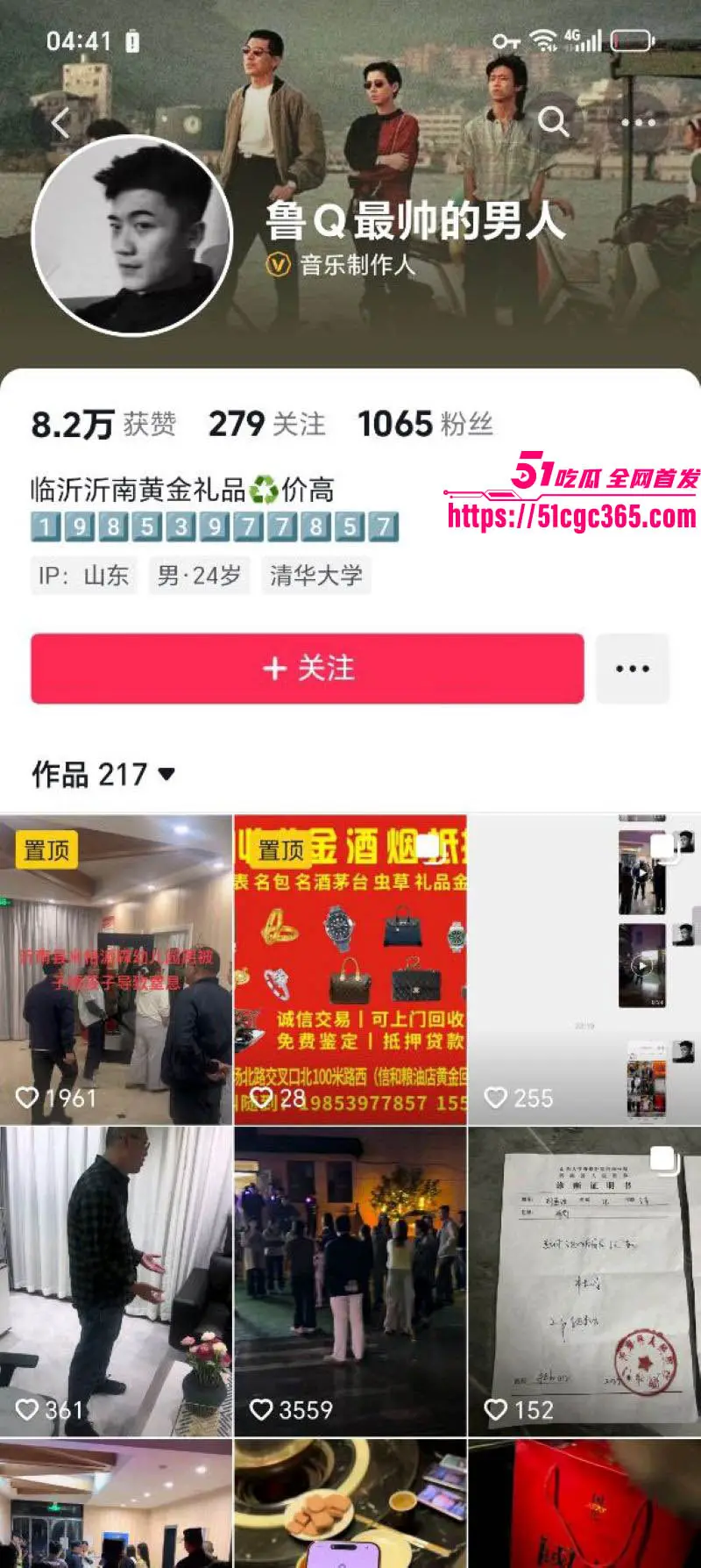 沂南米格派森幼儿园虐童事件 保安暴力阻录像 掐肚子关黑屋捂脸 孩子浑身淤青哭喊 简直禽兽不如！ 图1