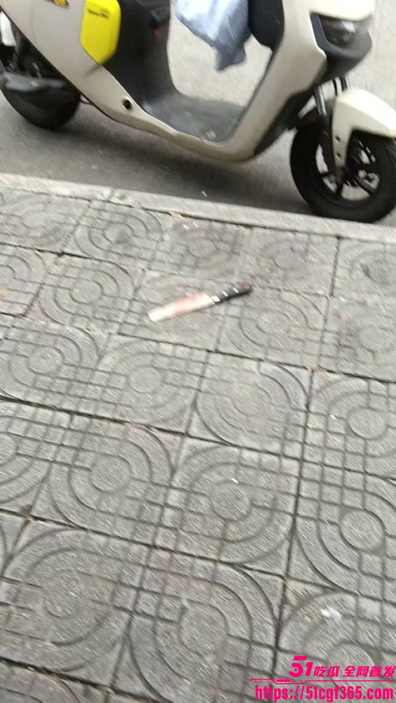 广西柳州柳北大润发 精神小伙斗殴持刀砍头皮事件 受害者头部中刀头皮掀起 血腥程度极高! 图4