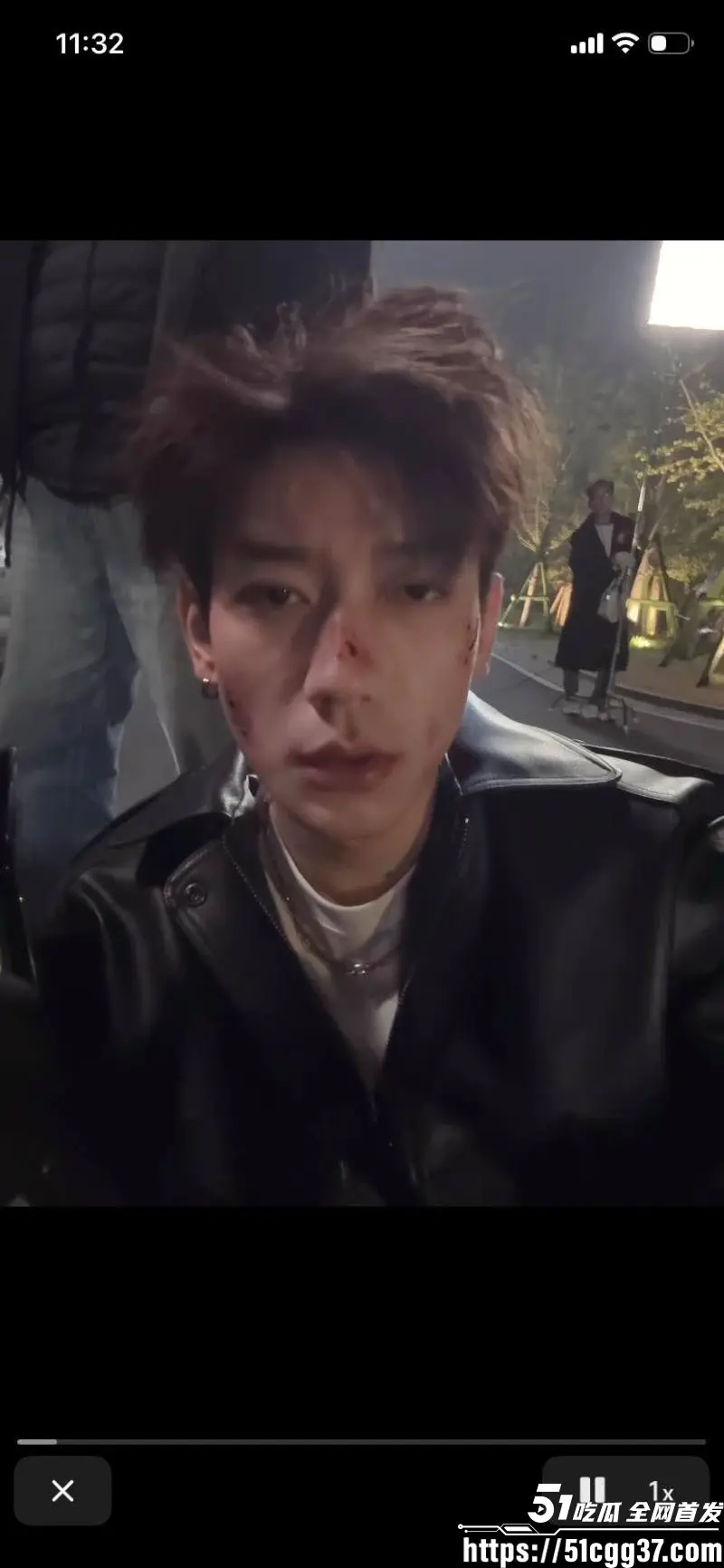 短剧演员 鹿单东 塌房 前妻实名爆婚内家暴出轨持械伤人 服刑10月谎称因病休养 伤情鉴定开房视频曝光引众怒! 图8