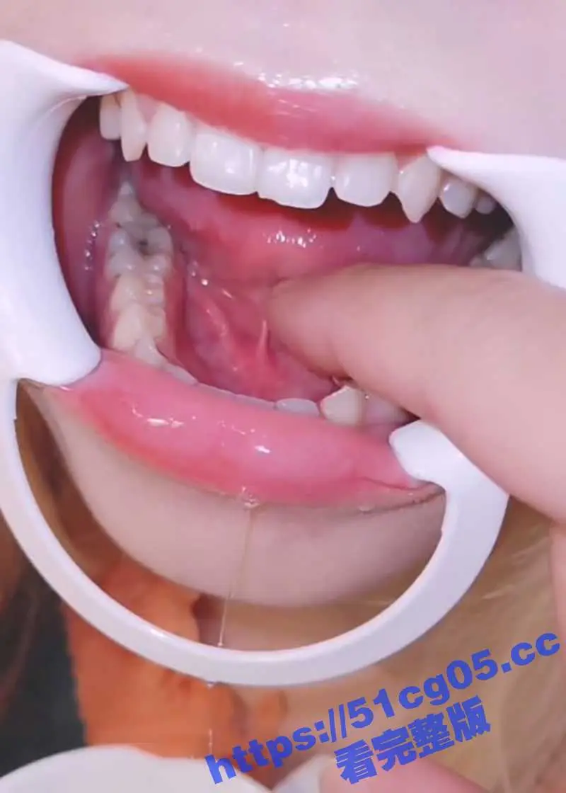 超极品美女口腔检查系列 粉嫩口腔小舌头 紧致的喉咙 这嘴巴用来深喉口爆绝对很爽 ! 图6