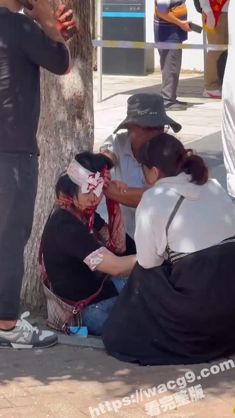 突发事件!厦门一对夫妻从思明区法院鼓浪屿分院办理离婚后 丈夫突然从包里拿出折叠刀捅向妻子头部 图5