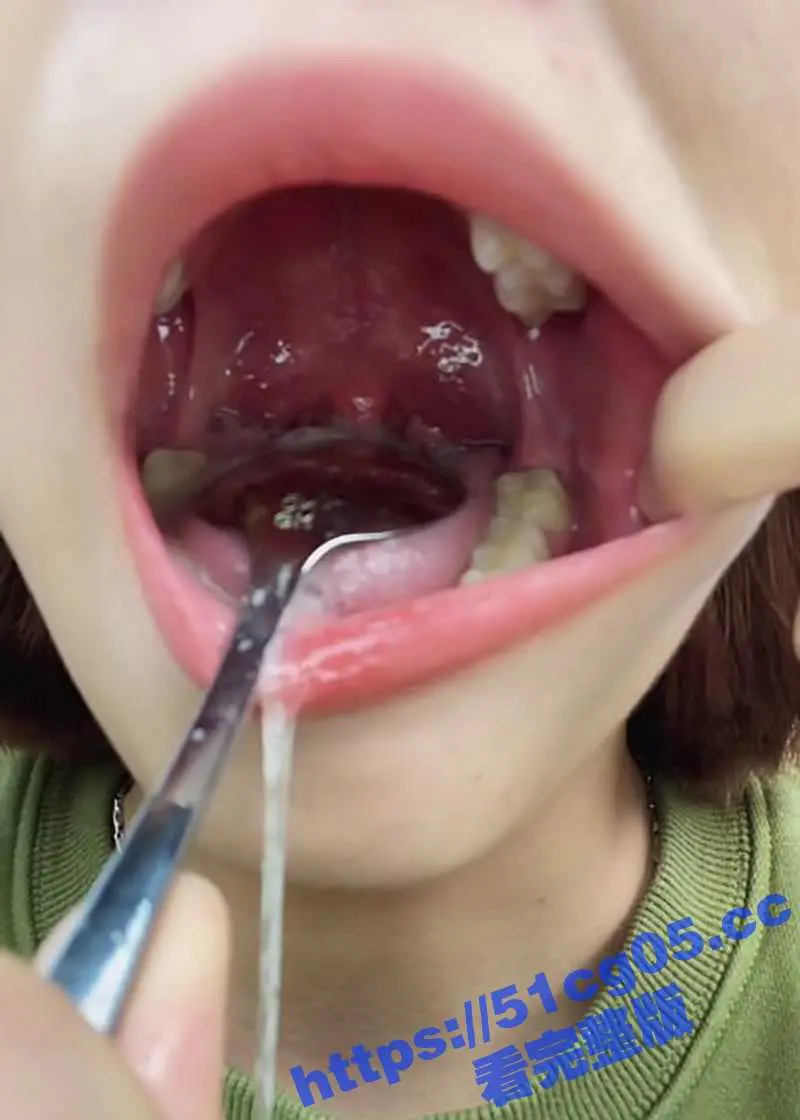 超极品美女口腔检查系列 粉嫩口腔小舌头 紧致的喉咙 这嘴巴用来深喉口爆绝对很爽 ! 图5