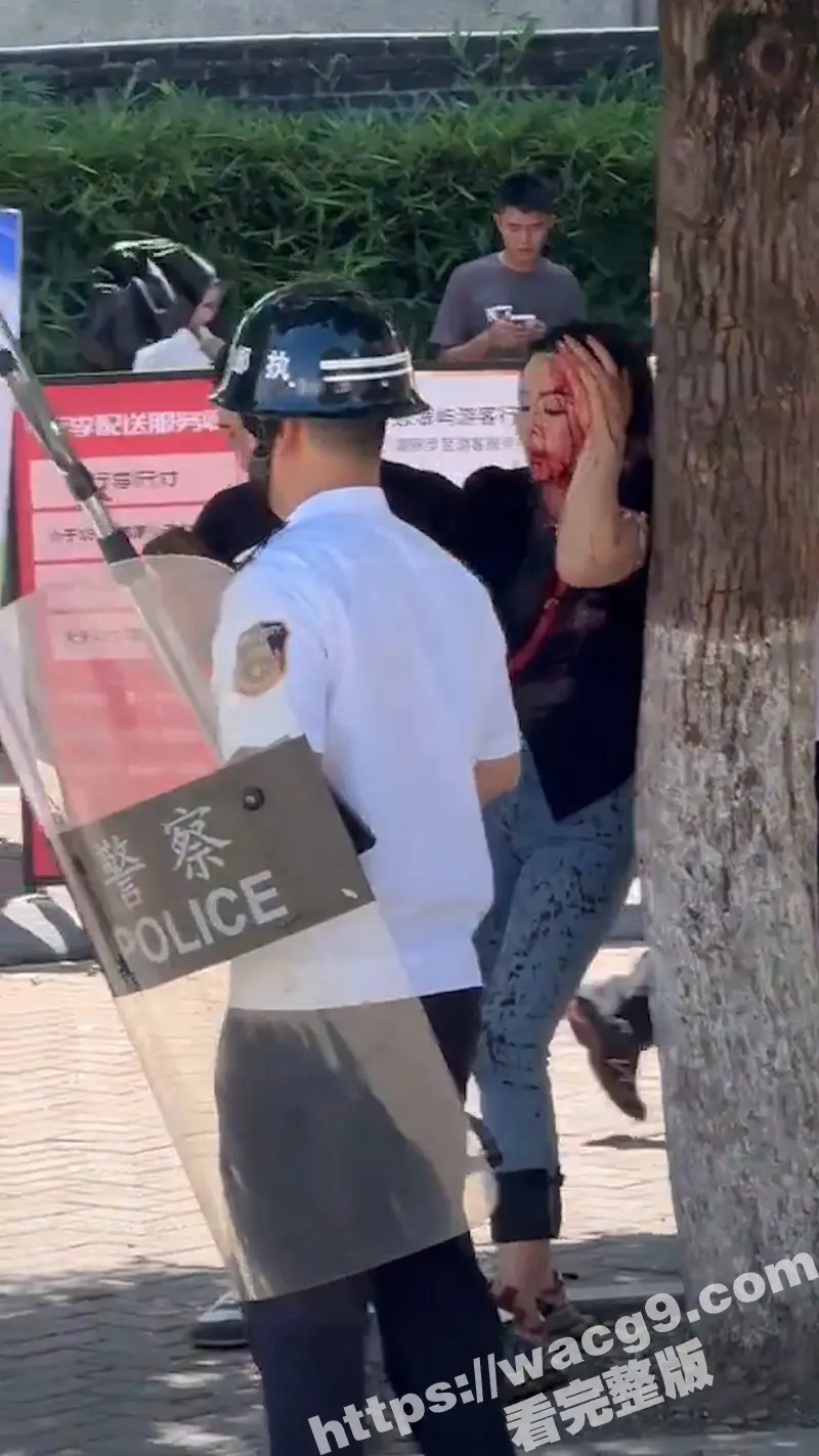 突发事件!厦门一对夫妻从思明区法院鼓浪屿分院办理离婚后 丈夫突然从包里拿出折叠刀捅向妻子头部 图3