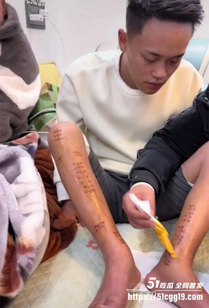 蓝战非事件再现！知名网红 非洲洋洋 诱骗博主曾凡贵网诈国人 反抗竟遭虐待打断双腿！ 图6