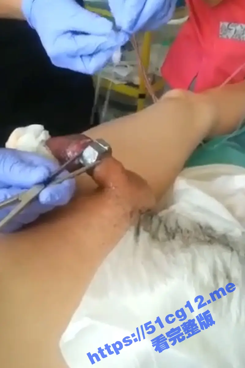 搞笑猎奇!把螺母套到鸡巴上取不下来 只能用电锯把螺丝据下来! 图1