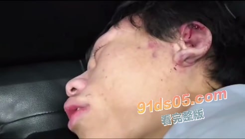 二次元界抽象人物 网络恶俗组织新月成员 曹志豪 线下被多人围殴 打的鼻青脸肿 图3