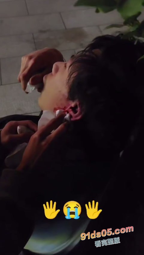 二次元界抽象人物 网络恶俗组织新月成员 曹志豪 线下被多人围殴 打的鼻青脸肿 图4