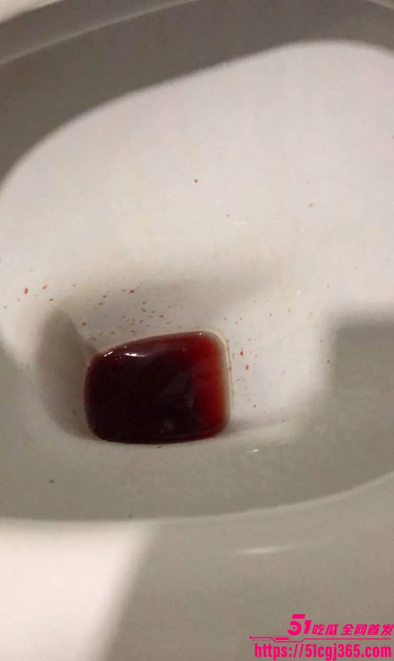 国庆节撸管翻车 狠人瓜友把自己撸进ICU 聊天记录全爆疯狂自述 瓜友们要节制啊!