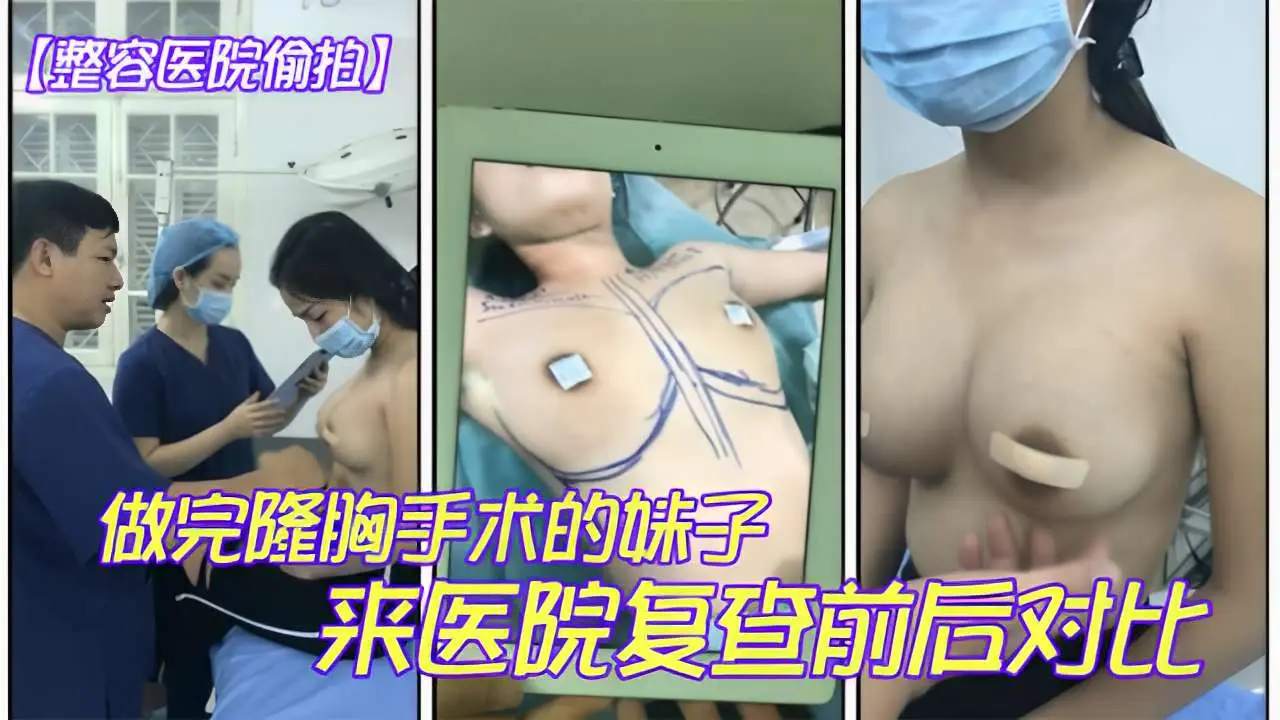 整容医院偷拍做完隆胸手术的咪子来医院复查前后对比