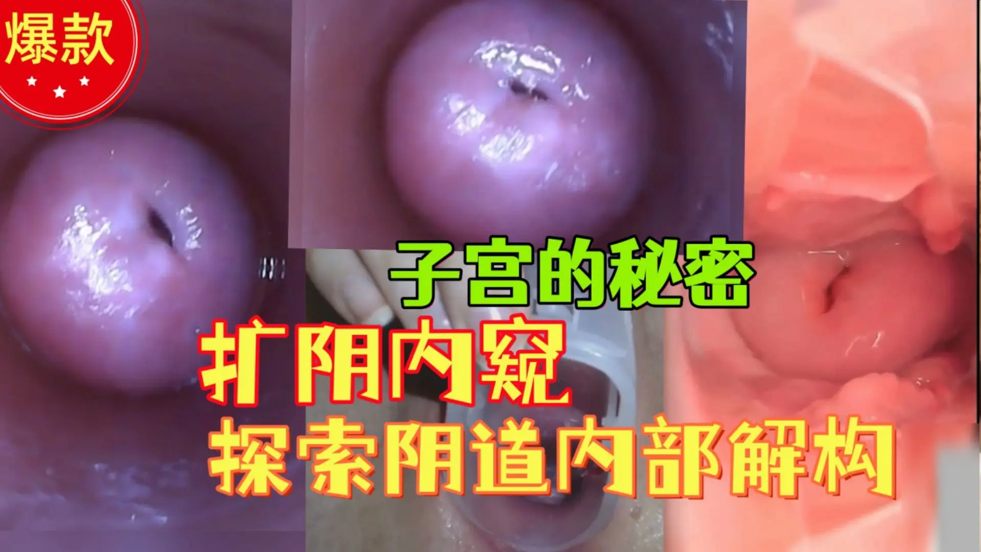 {扩阴内窥子宫}把摄像头插入阴道观察子宫解构，从内部探索女性生殖器解构，独家稀缺资源！
