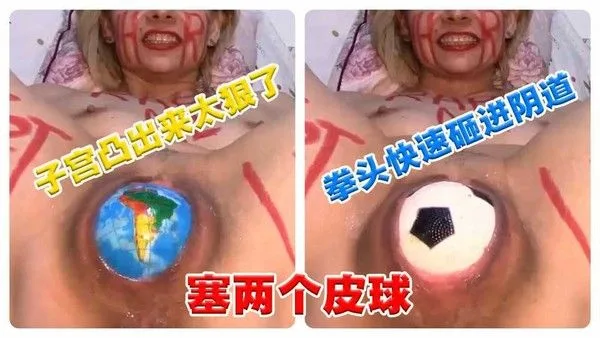 超重口味 往逼塞两个皮球，拳头快速砸进阴道，子宫外翻！