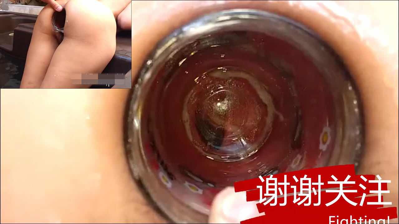往屁眼里塞个杯子当窥镜用节约成本