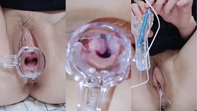 内窥镜探索粉嫩白虎火星虫洞