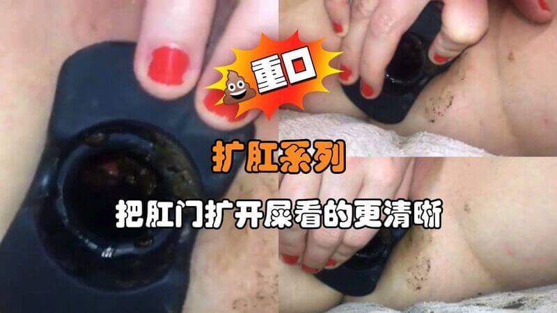 扩肛系列屎洞大张旗鼓！极致扩张视觉盛宴，清晰观赏屎尿之美