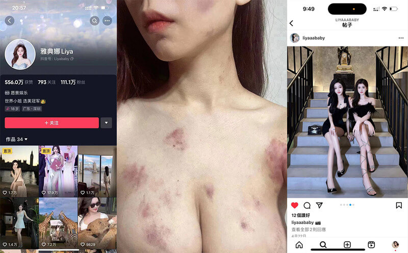 抖音百万粉丝 世界小姐选美冠军 孔丽梅 liya 被闺蜜骗去菲律宾被迫卖肉还债
